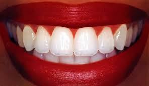 tooth-whitening-procedures